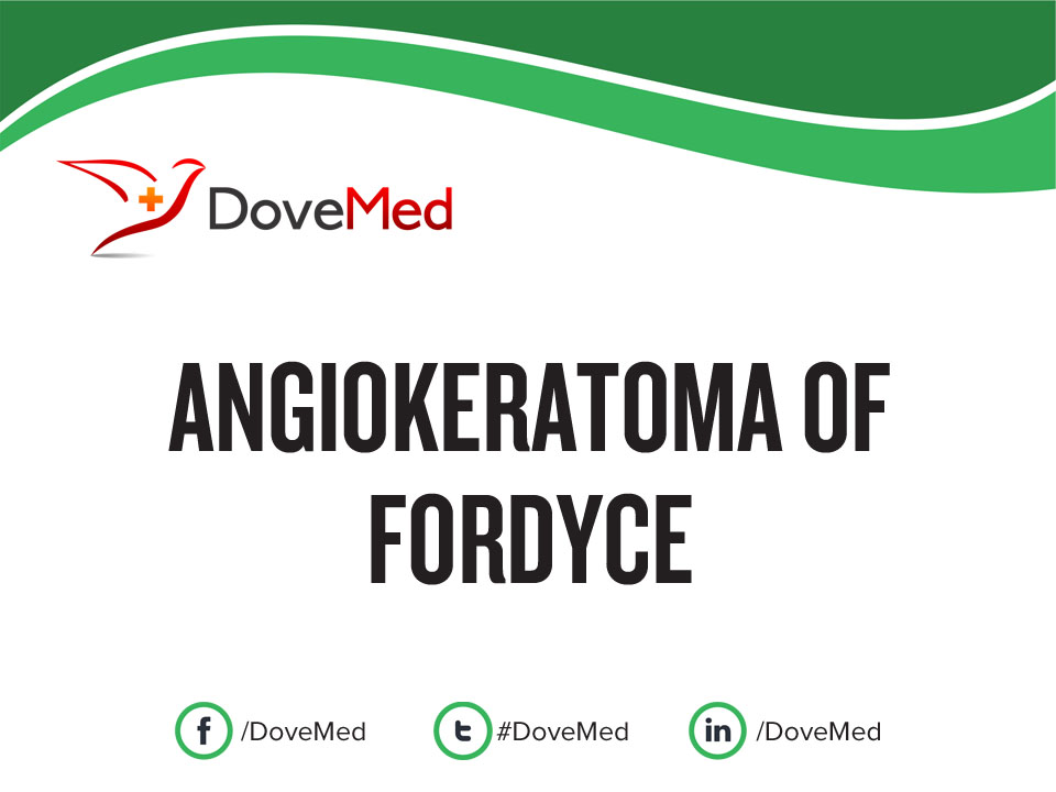 Angiokeratoma of Fordyce (affecting Scrotum)
