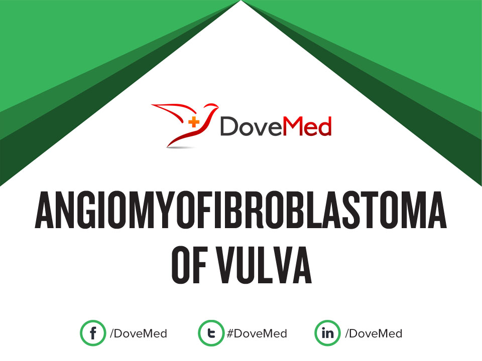 Angiomyofibroblastoma: A rare benign gynecologic tumor mistaken for a  bartholin cyst
