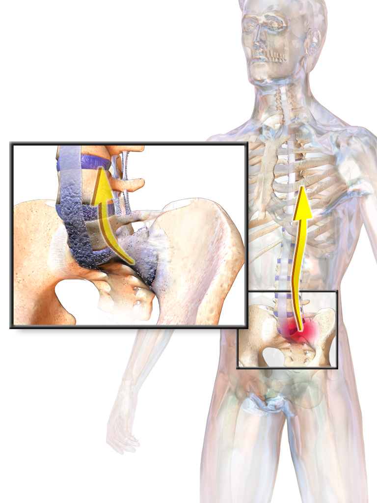 Watch What Kind of Arthritis Is Ankylosing Spondylitis video Watch What Kind of Arthritis Is Ankylosing Spondylitis video