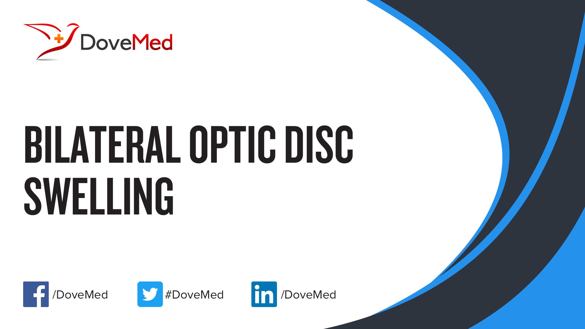 bilateral-optic-disc-swelling