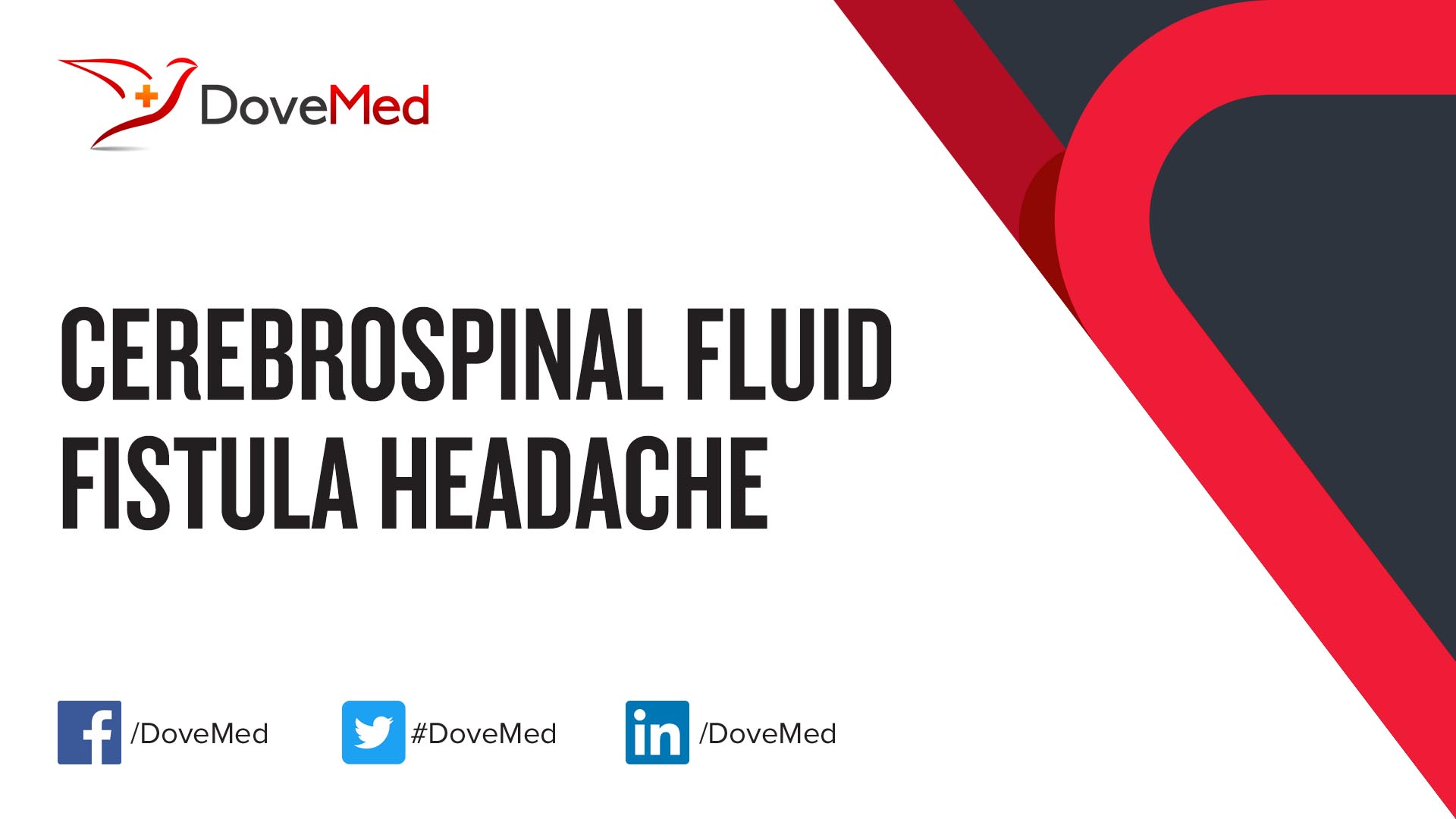 Cerebrospinal Fluid Fistula Headache