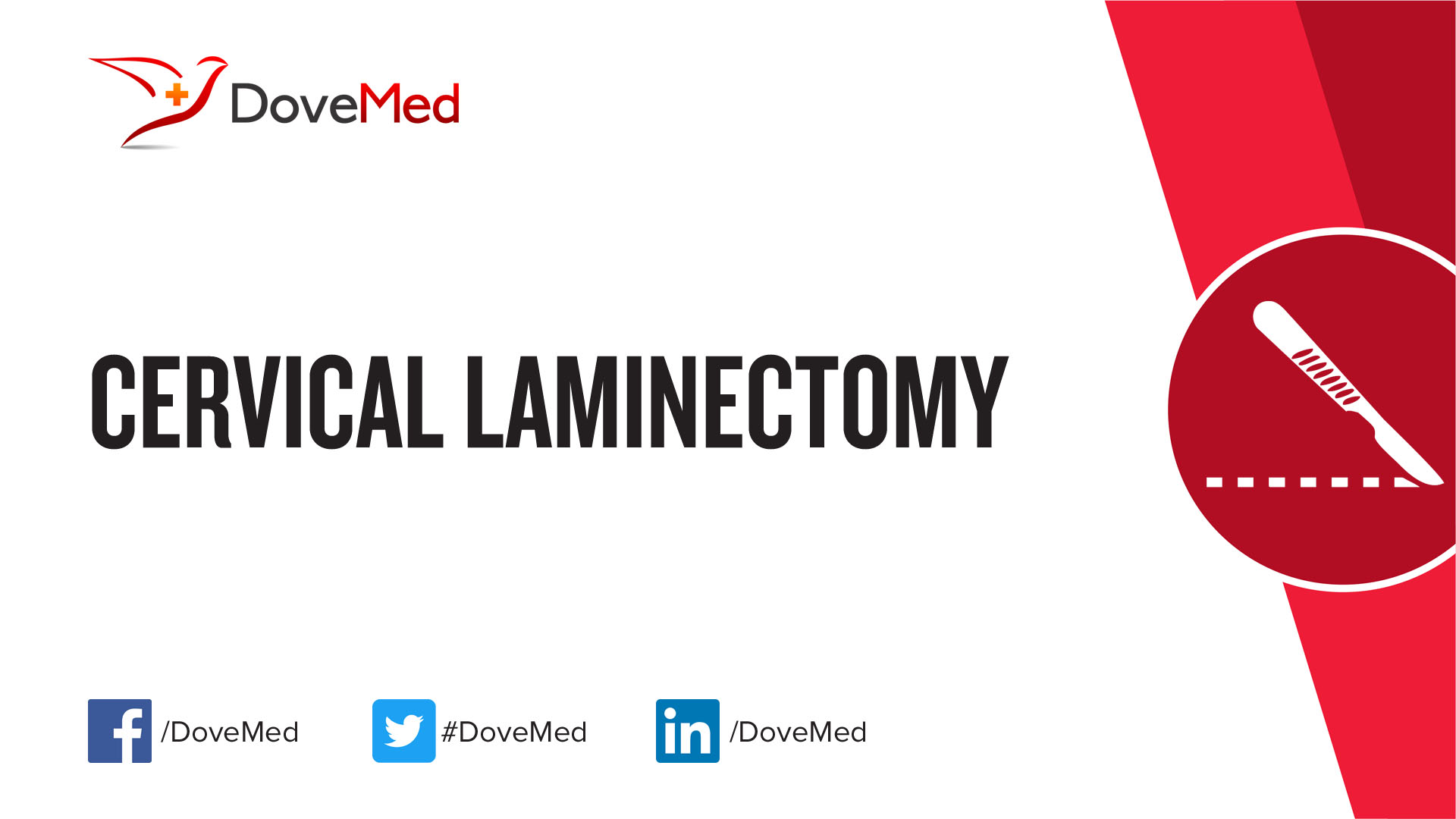 Cervical Laminectomy