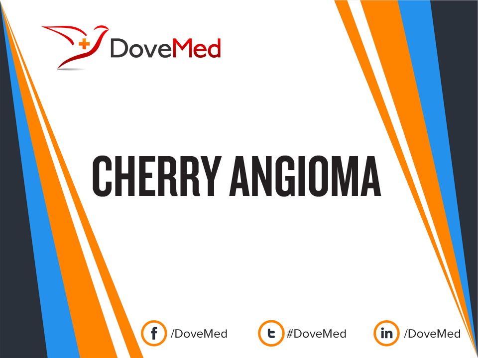 Cherry Angioma On Nose Skin Issue Solutions International Skin Care They can occur almost