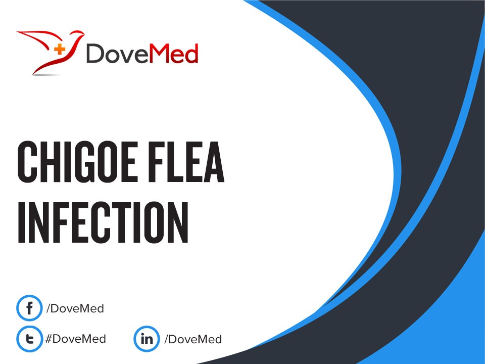 Chigoe Flea Infection