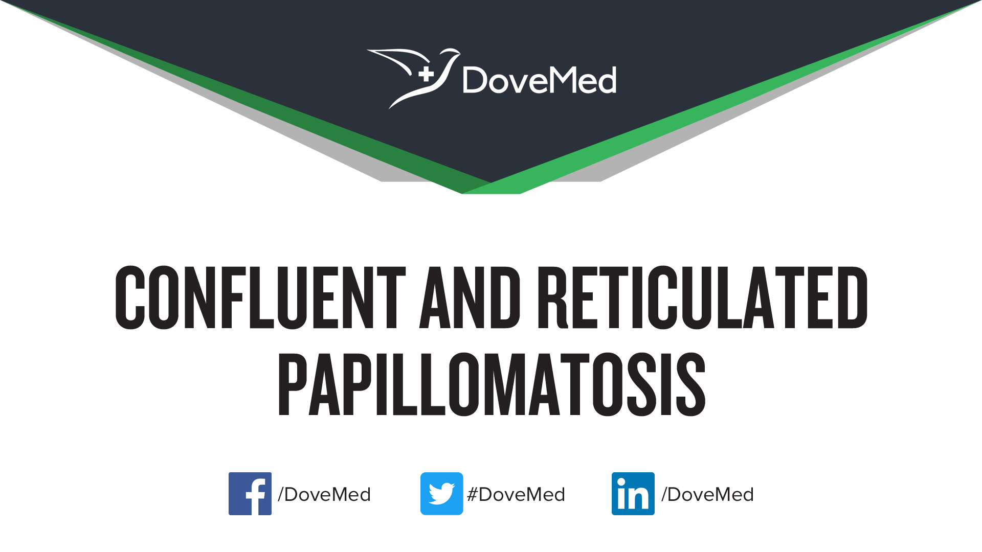 Pigmented reticulated papillomatosis, Conjunctival papilloma interferon - topvacanta.ro