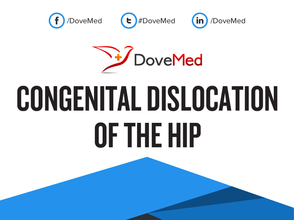 congenital-dislocation-of-the-hip-cdh