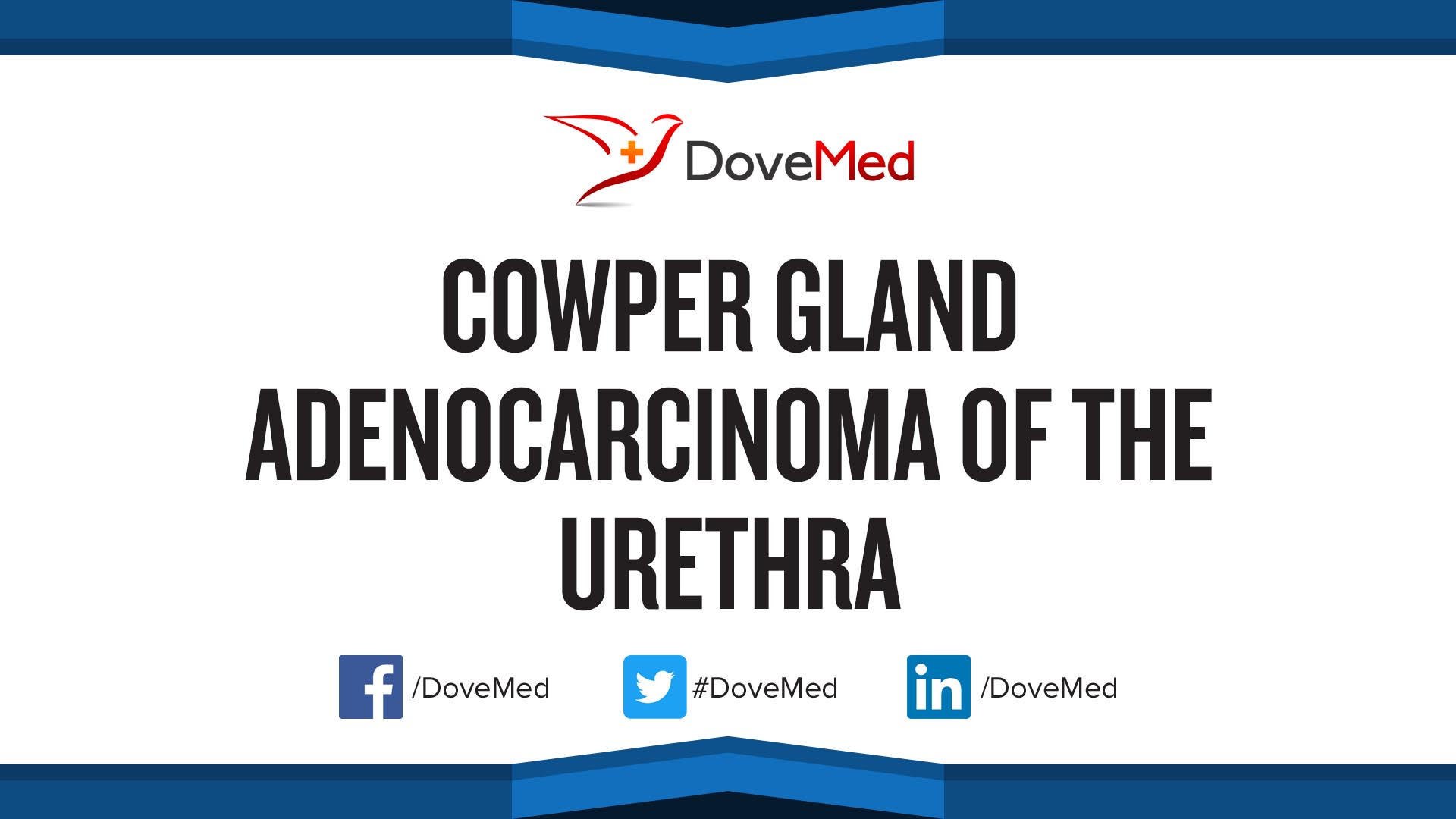 Cowper Gland Adenocarcinoma of the Urethra