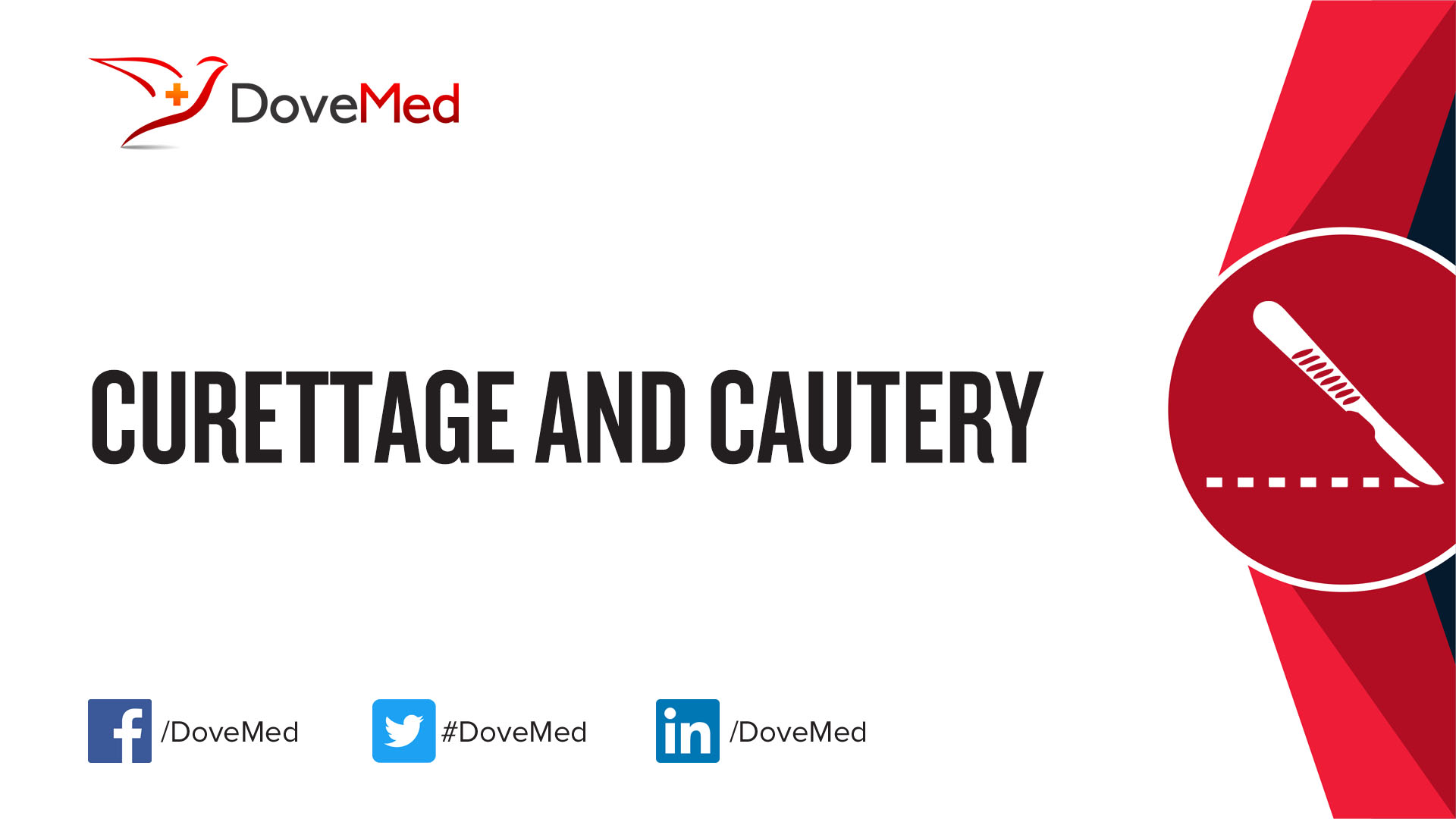 Curettage and Cautery