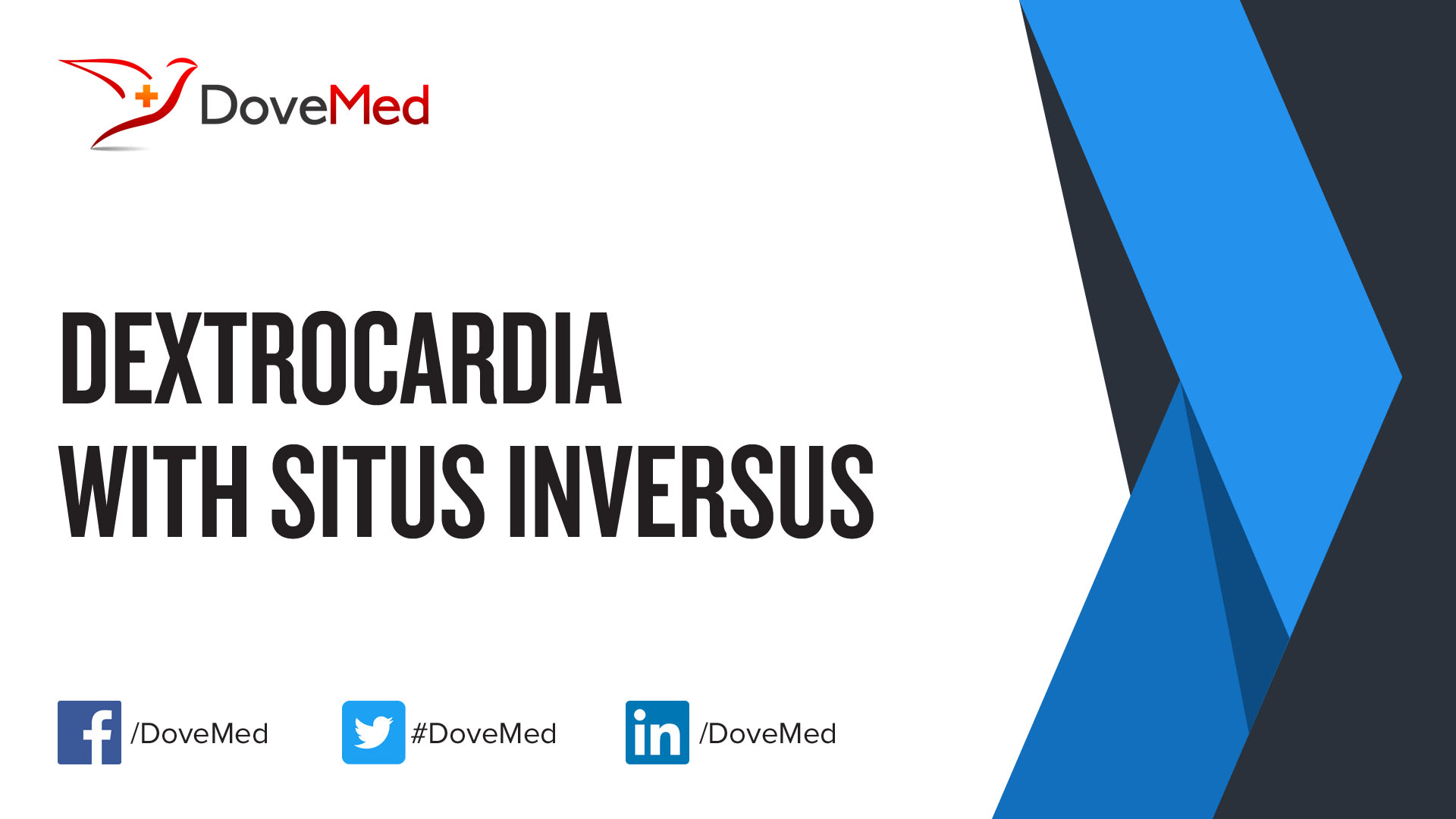 dextrocardia-with-situs-inversus