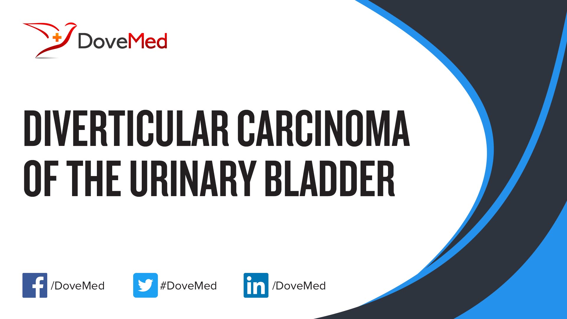 Diverticular Carcinoma of the Urinary Bladder