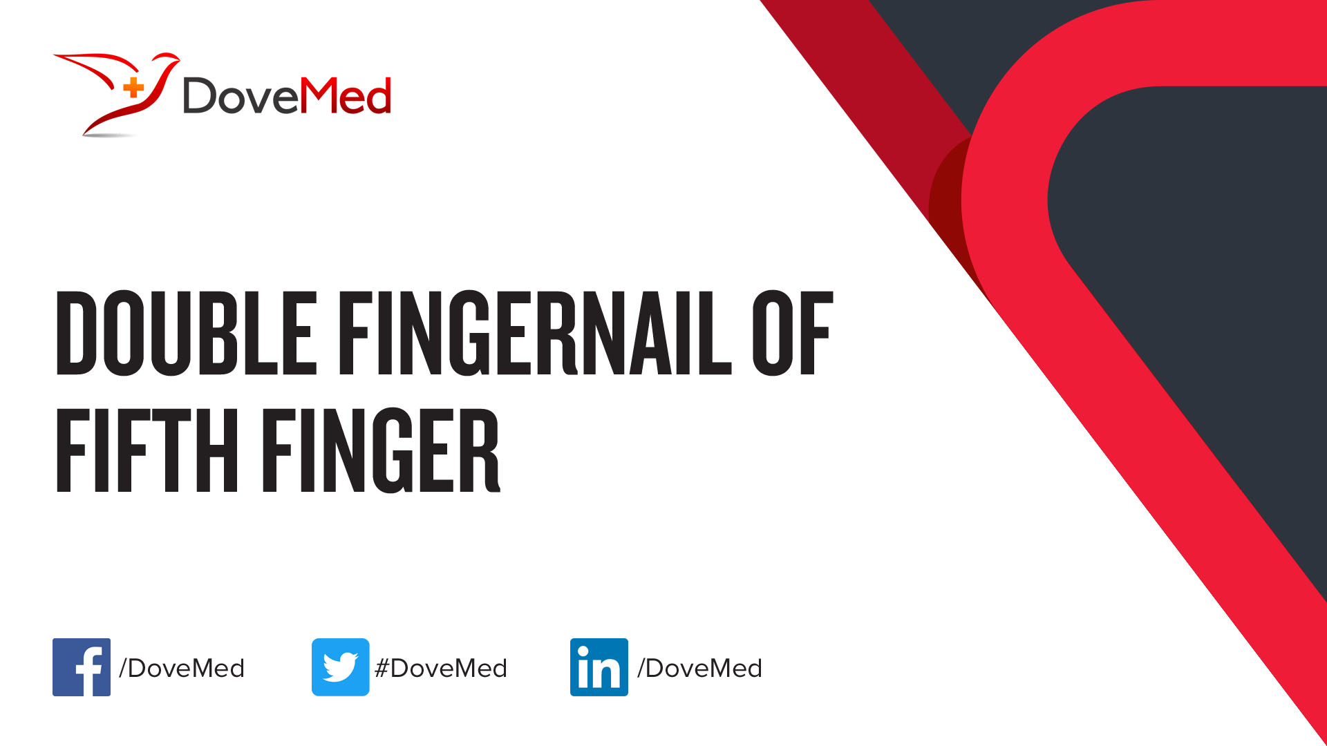 double-fingernail-of-fifth-finger