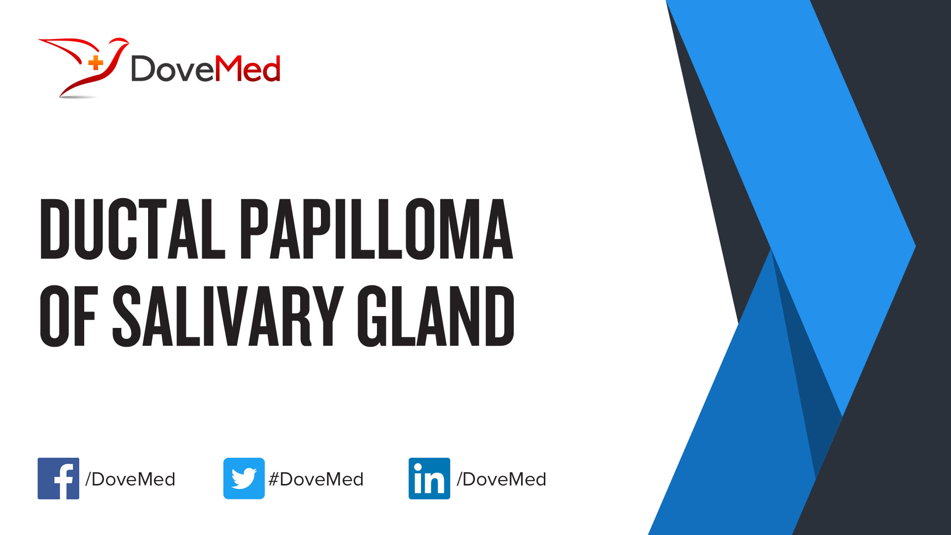 ductal papilloma minor salivary gland