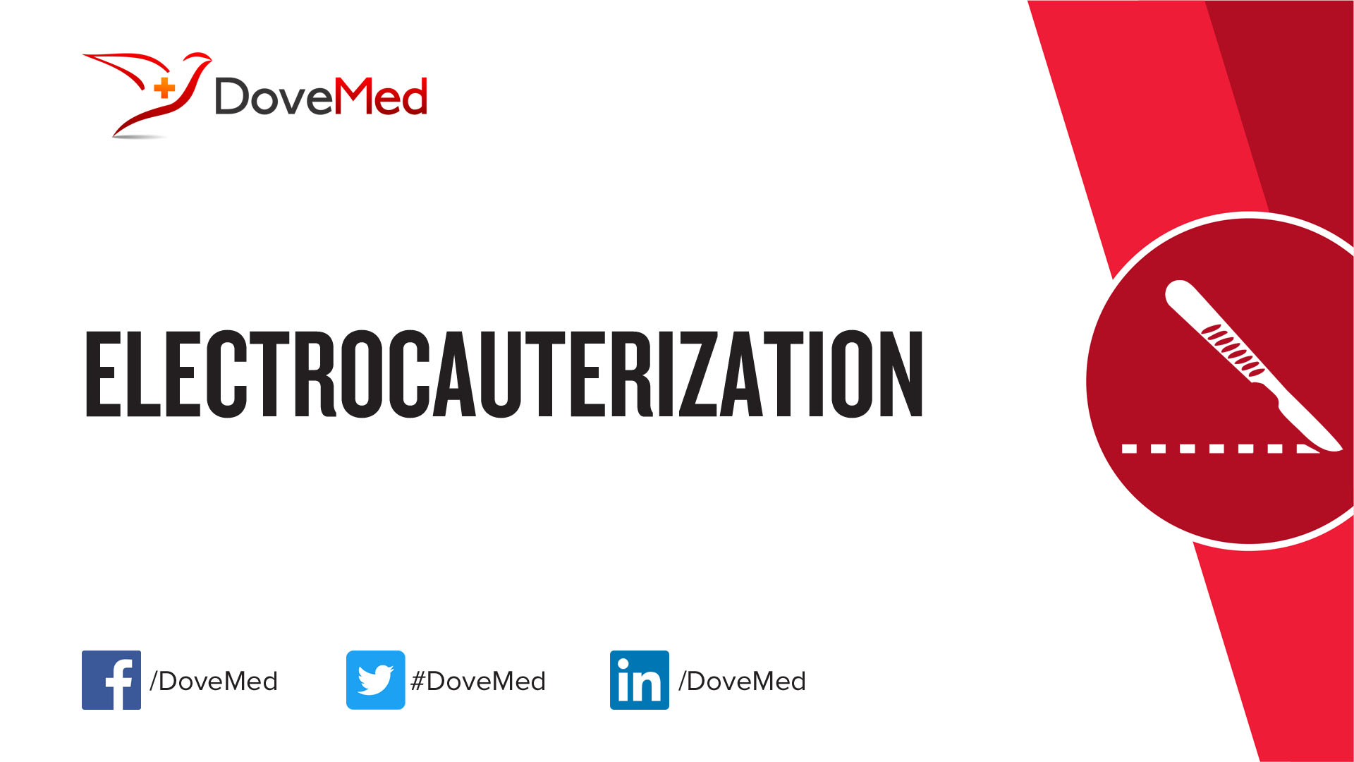 Electrocauterization