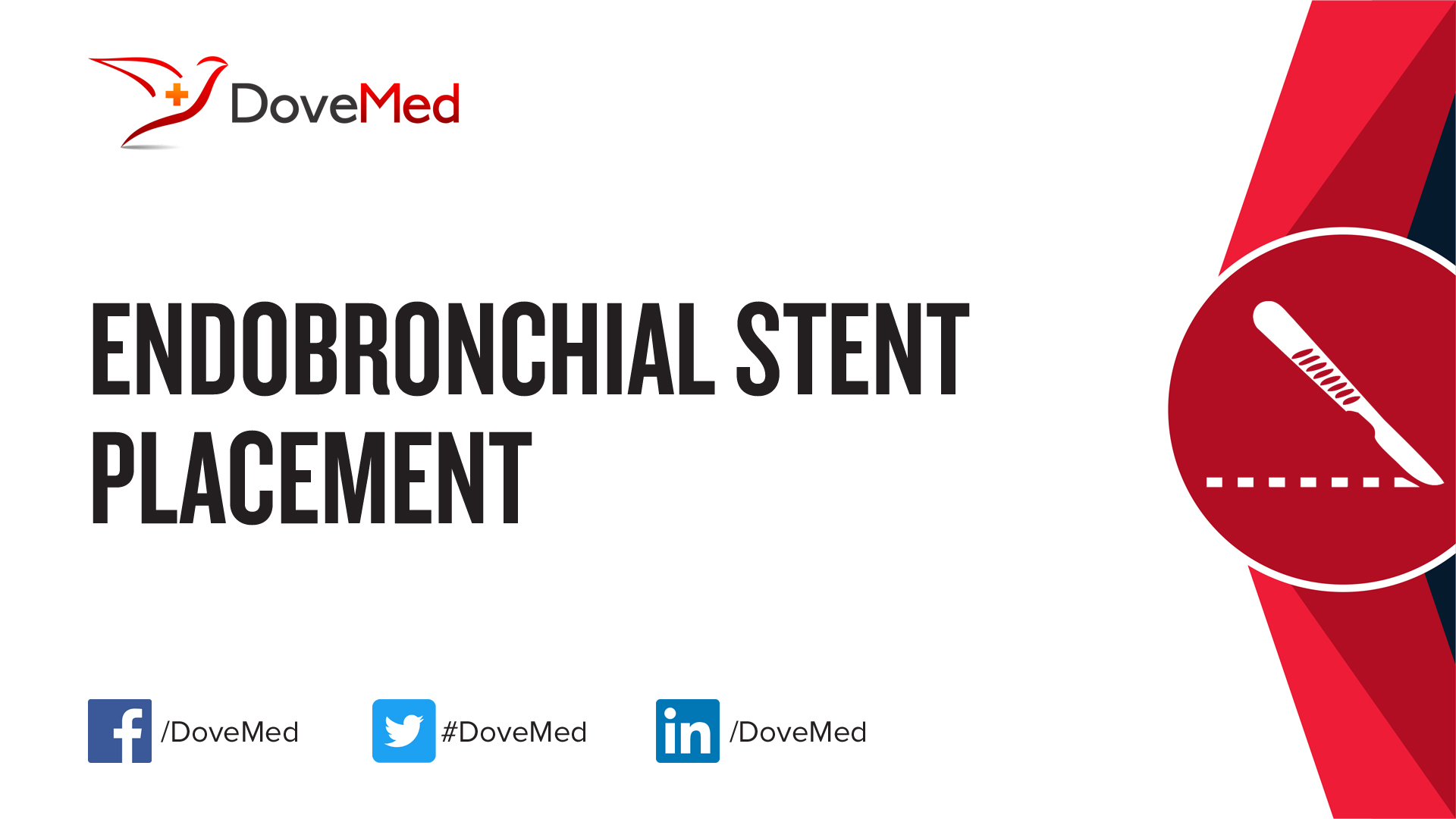 Endobronchial Stent Placement