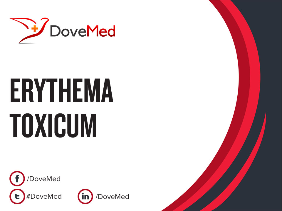 erythema-toxicum