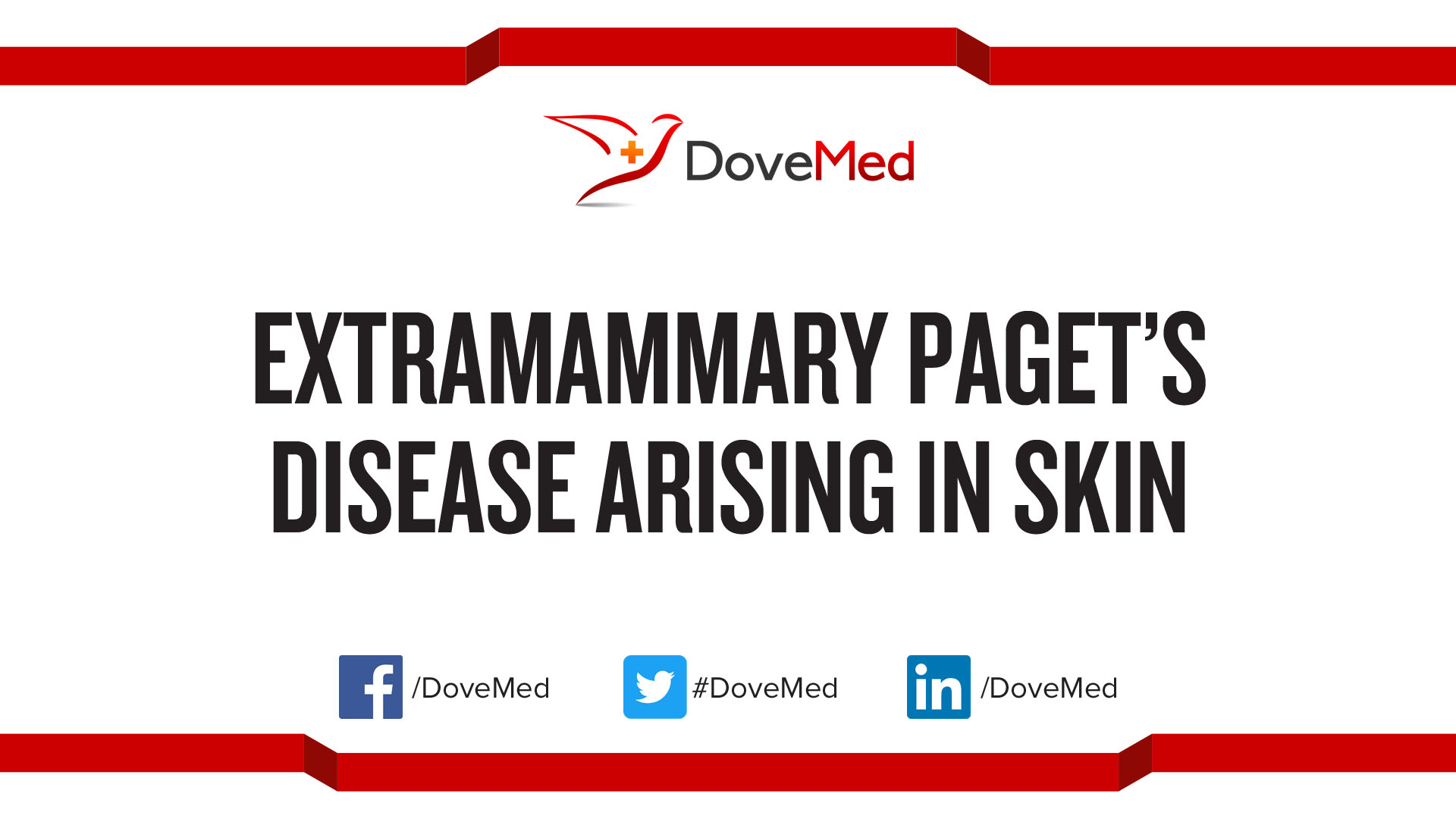 Extramammary Paget’s Disease arising in Skin