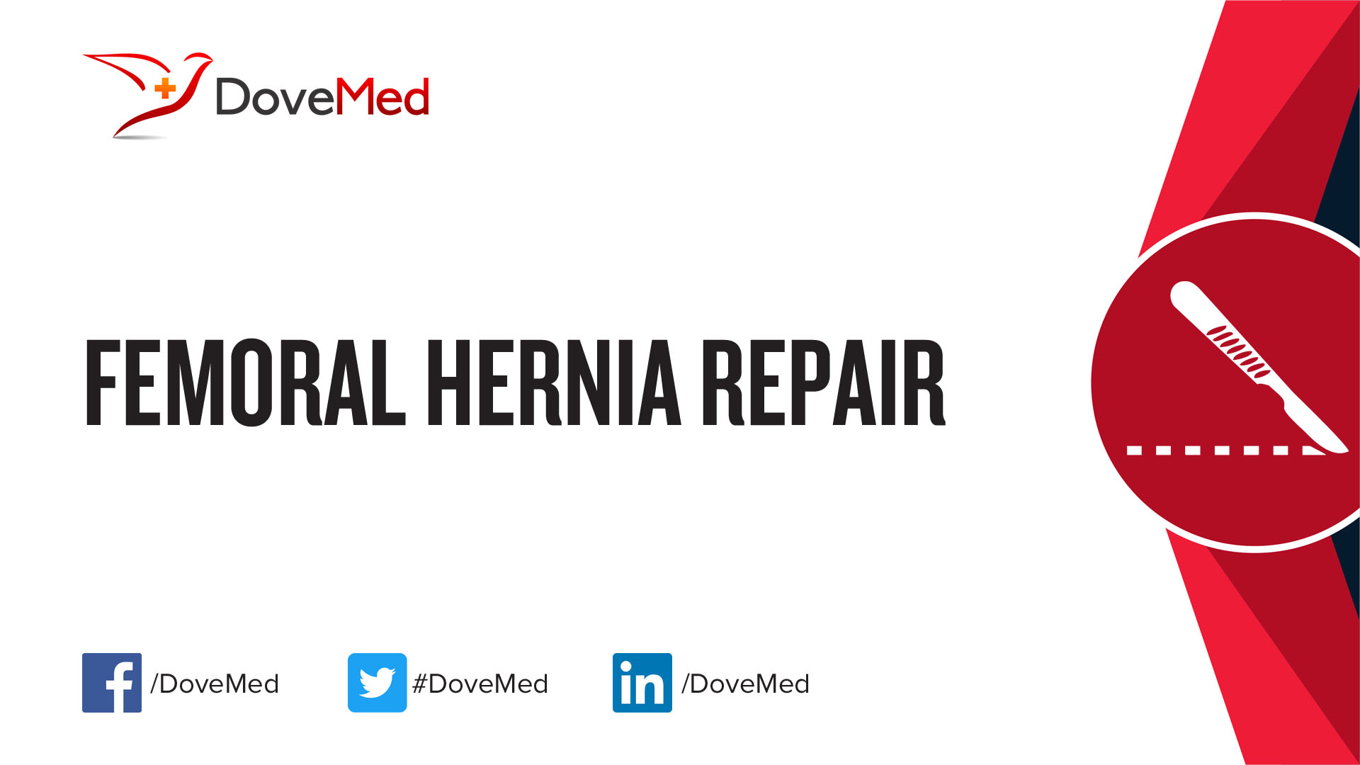 Femoral Hernia Repair - DoveMed