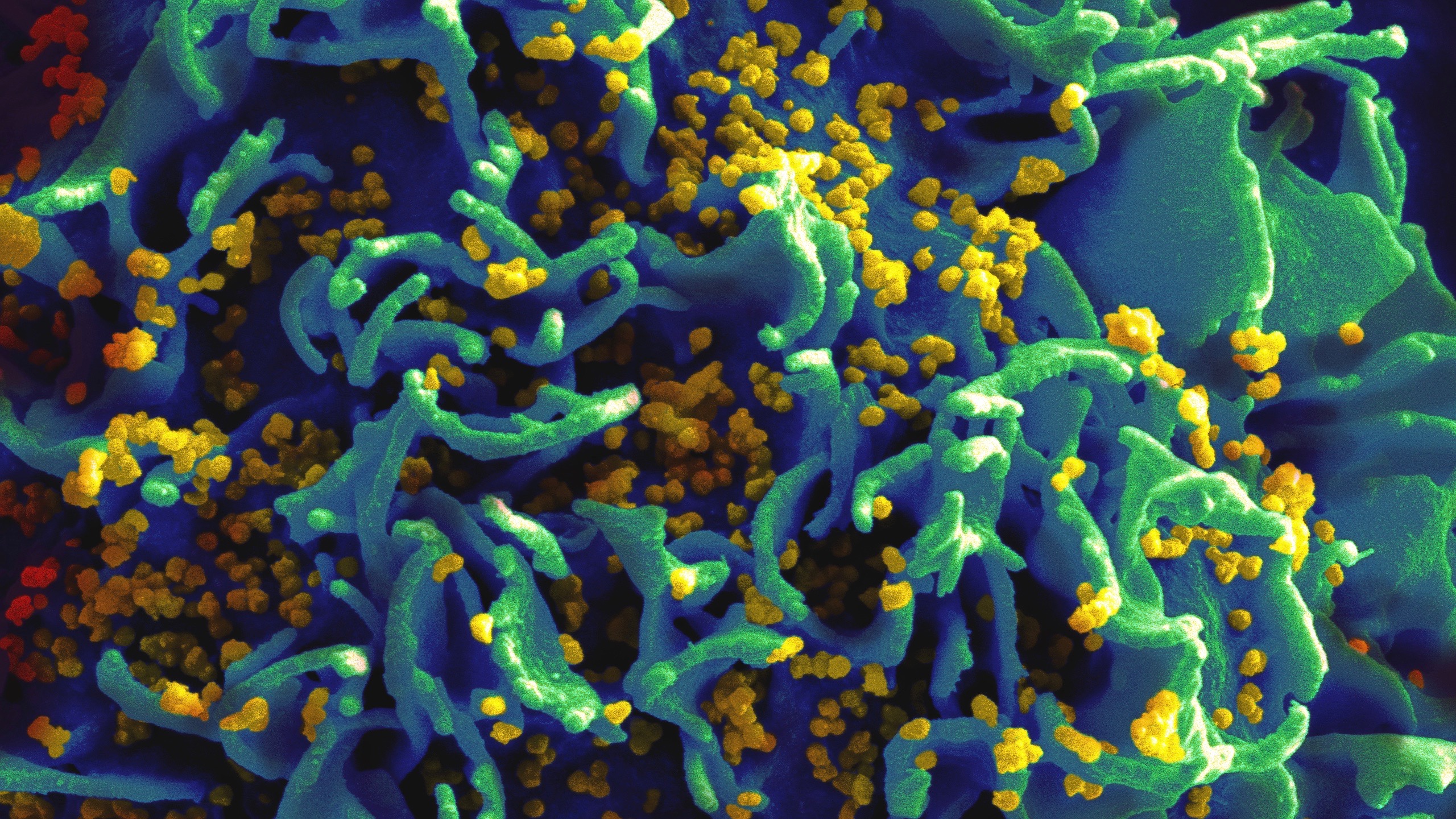 AIDS An Approach For Targeting HIV Reservoirs