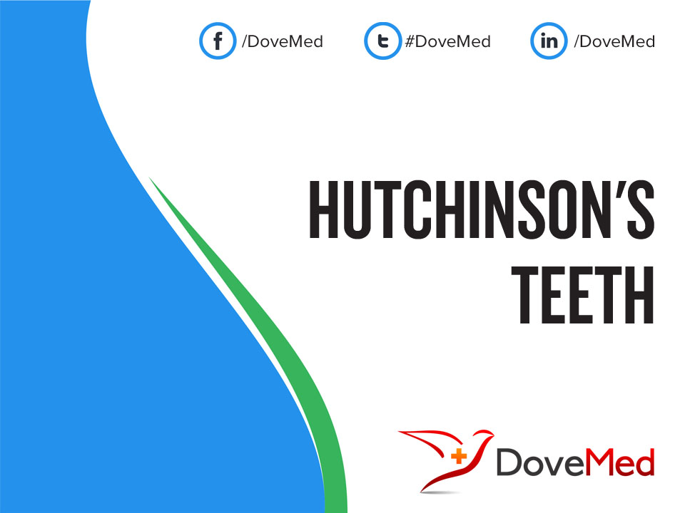 Hutchinson's Teeth