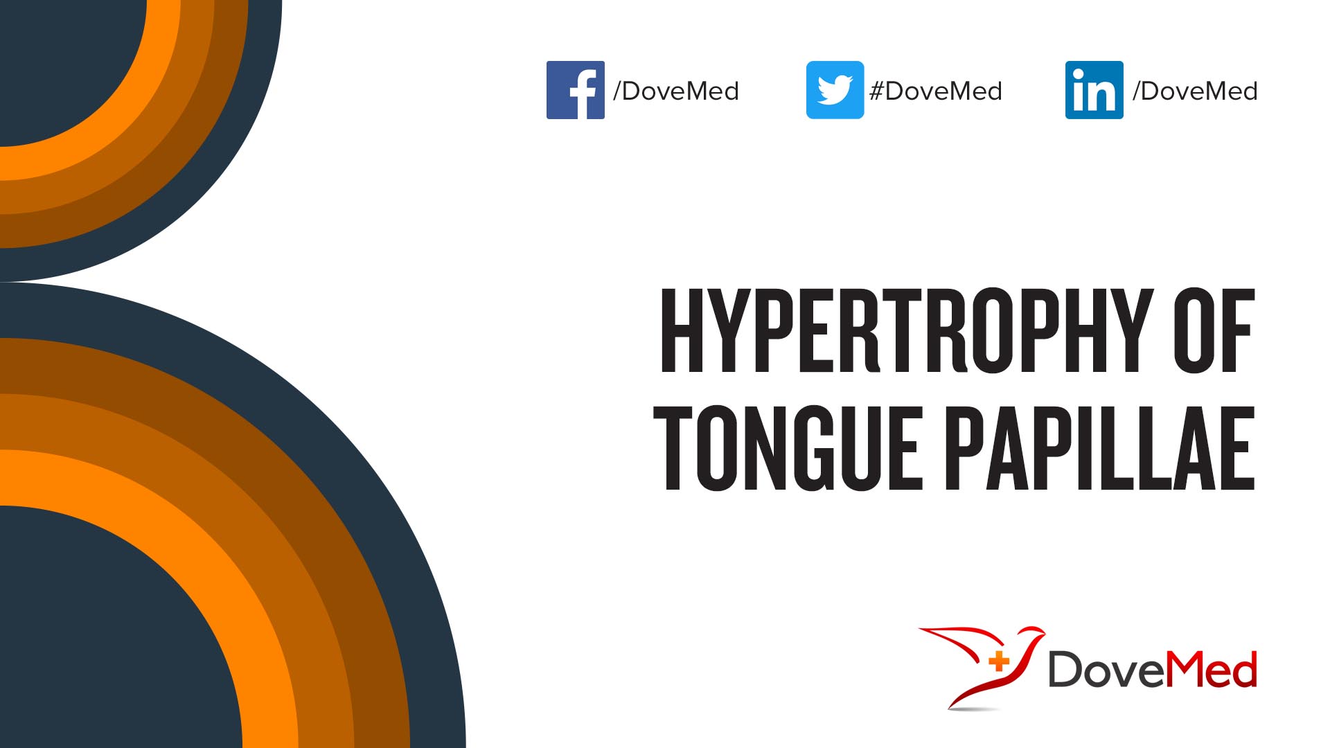 Hypertrophy of Tongue Papillae