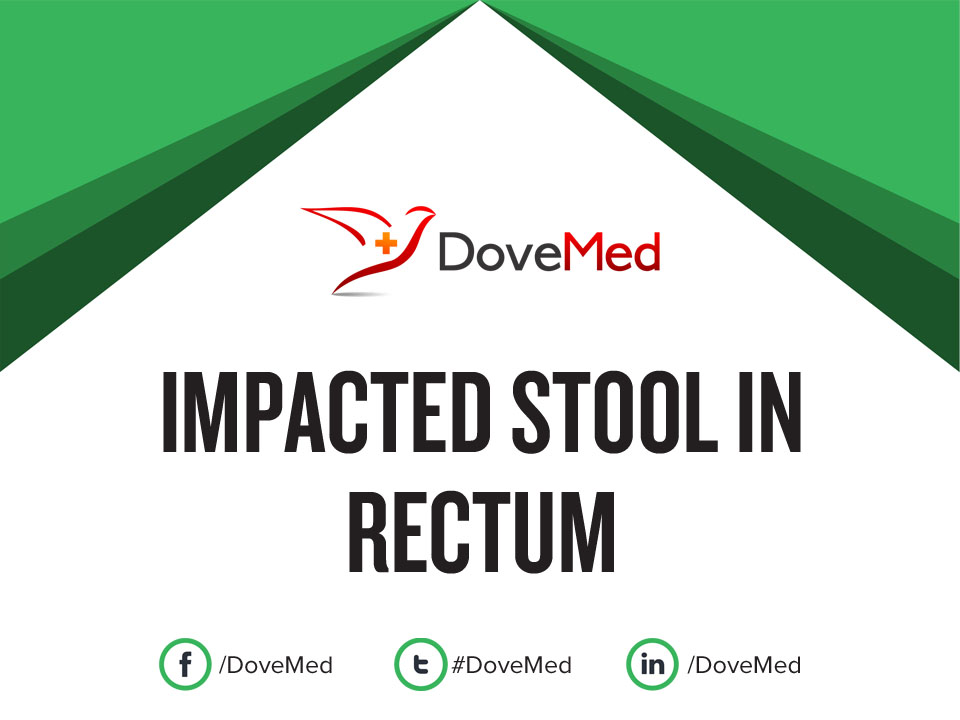 impacted-stool-in-rectum