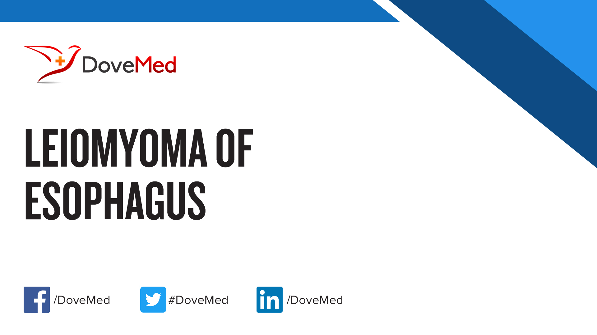 Leiomyoma of Esophagus