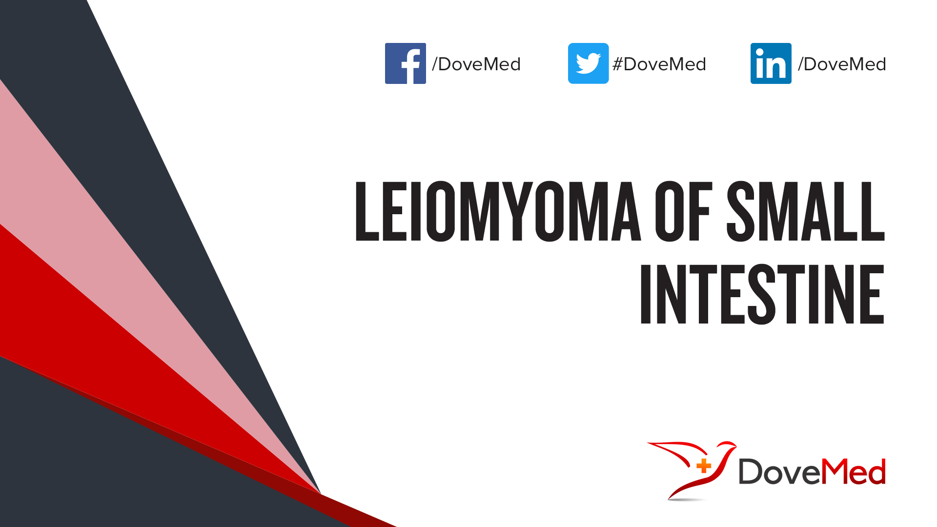 leiomyoma-of-small-intestine