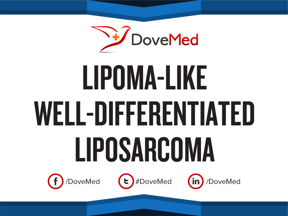 Lipoma-like Well-Differentiated Liposarcoma