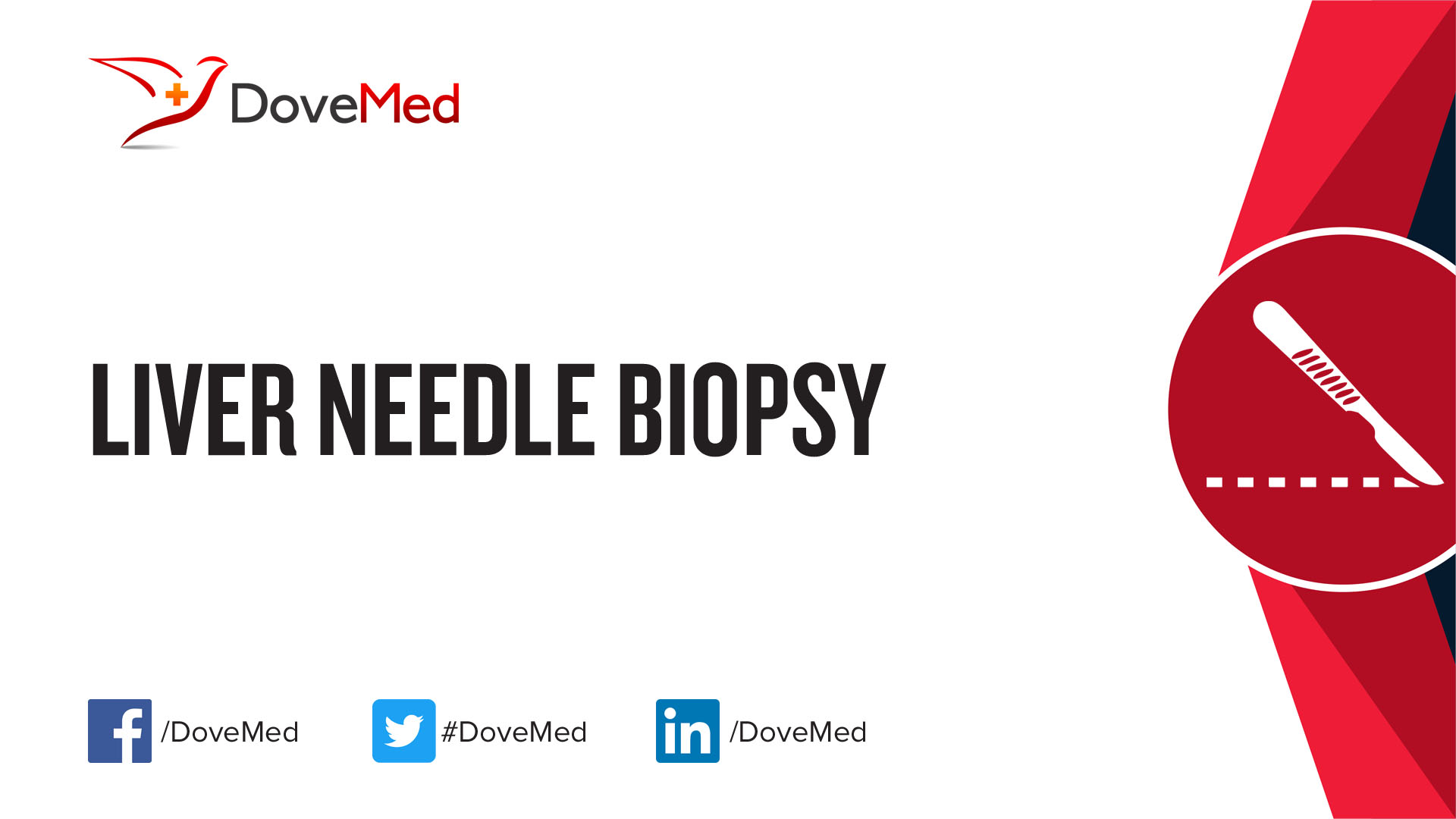 liver-needle-biopsy