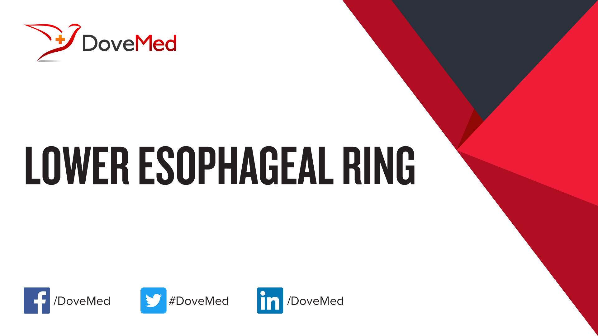 esophageal web | pacs