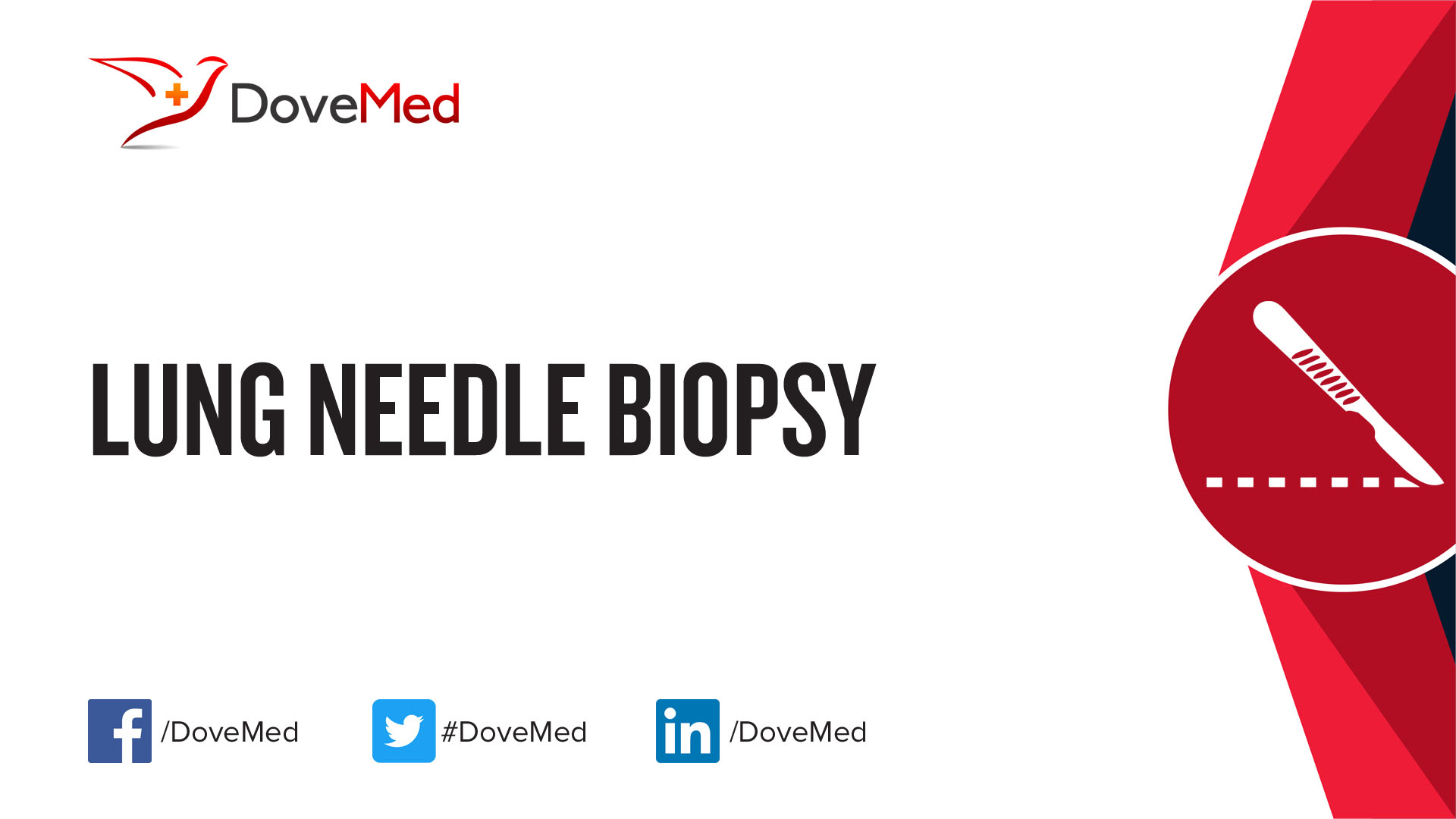 lung-needle-biopsy