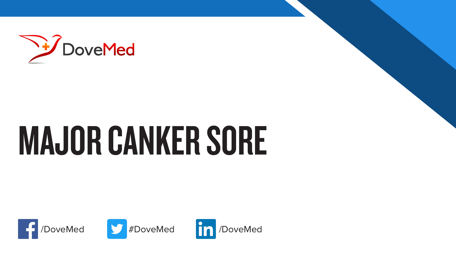 major-canker-sore