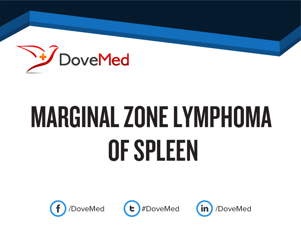 Marginal Zone Lymphoma of Spleen