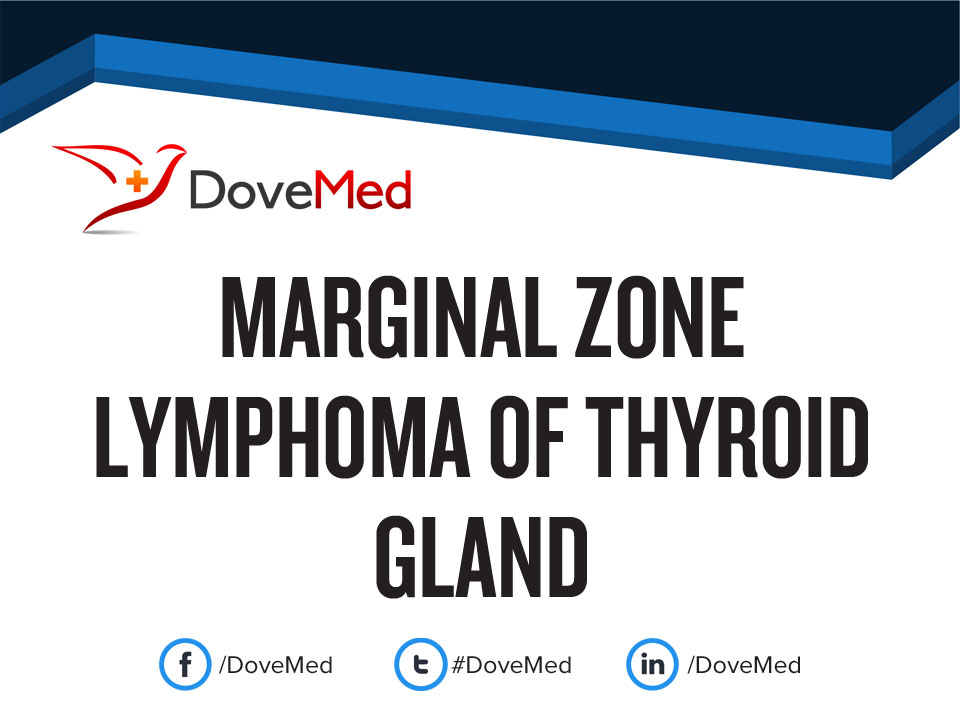Marginal Zone Lymphoma of Thyroid Gland