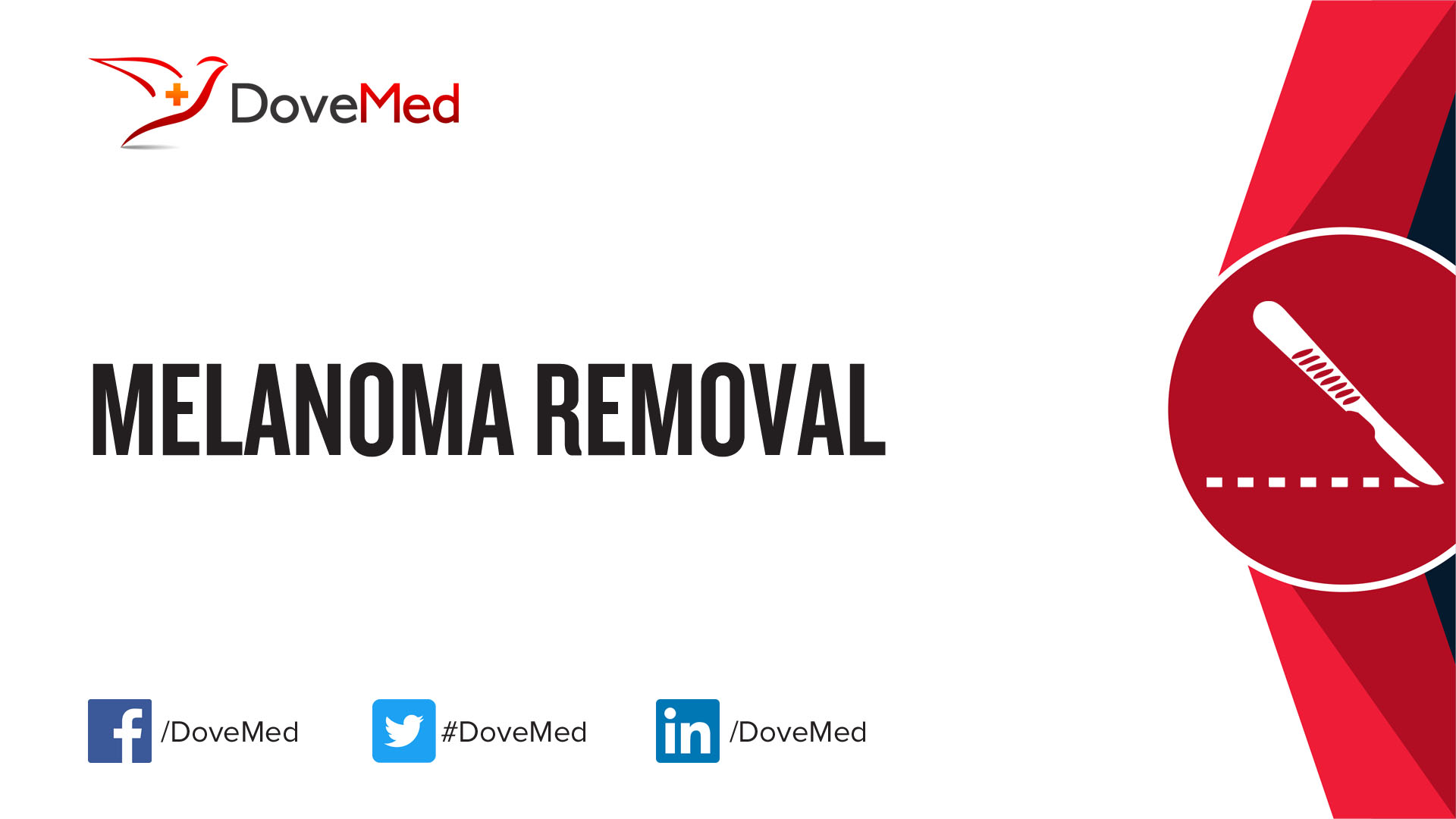 melanoma-removal