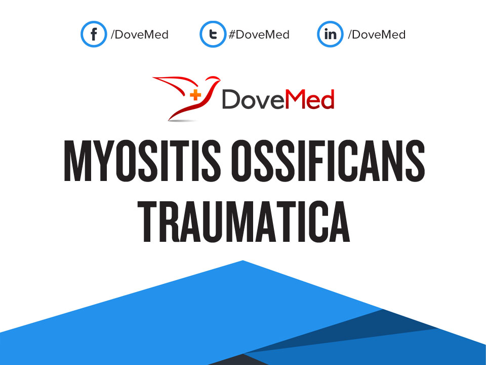 myositis-ossificans-traumatica