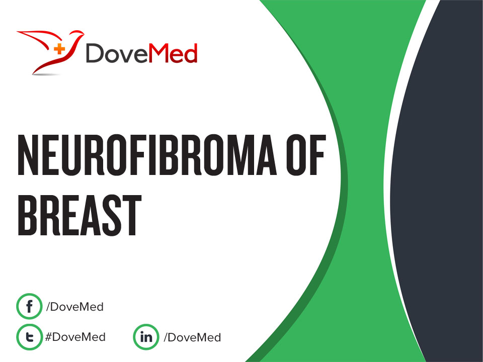 Neurofibroma of Breast - DoveMed