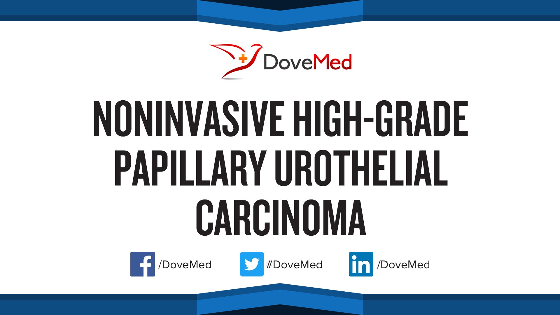 what-is-high-grade-urothelial-carcinoma