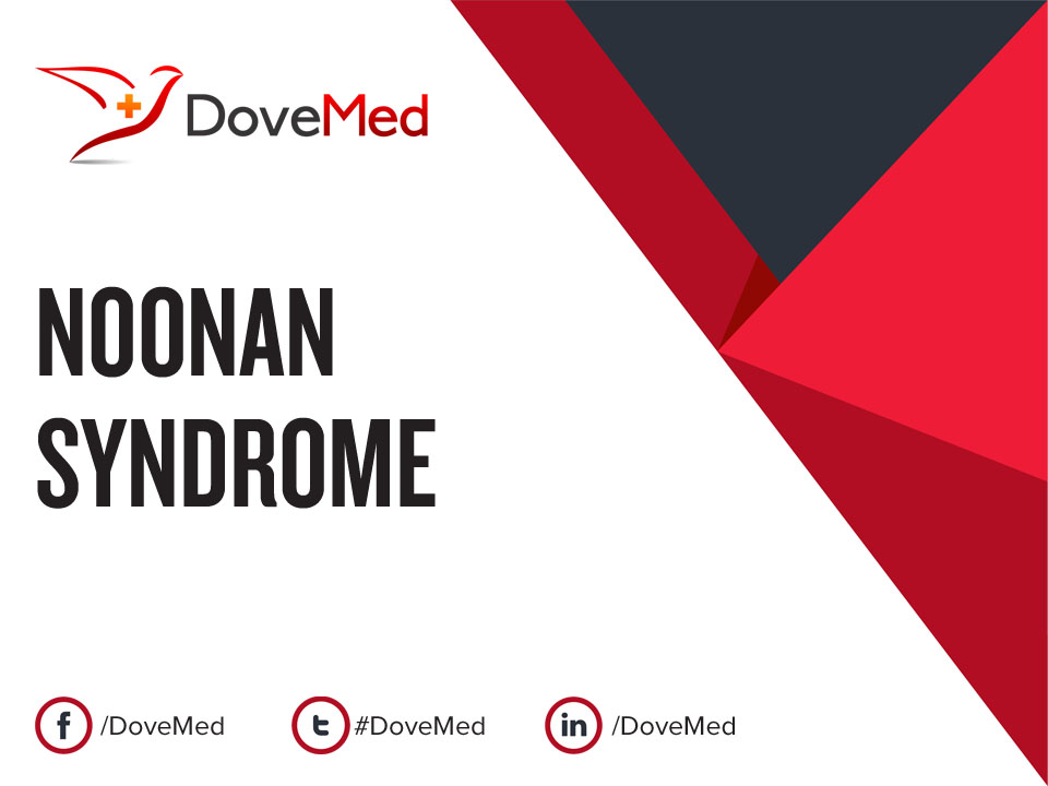 noonan-syndrome