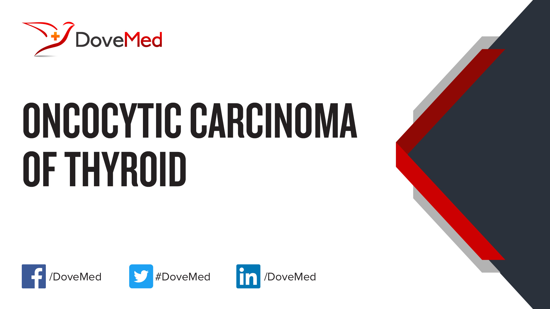 Oncocytic Carcinoma of Thyroid