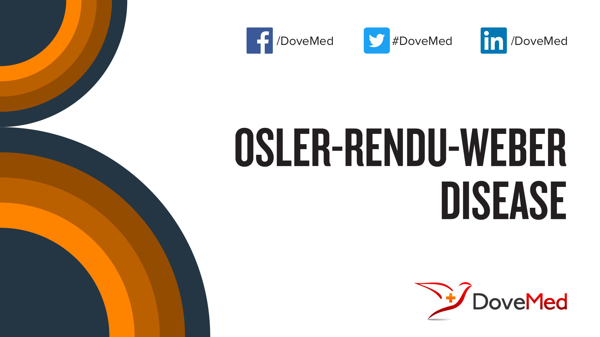 Osler Weber Rendu Syndrome