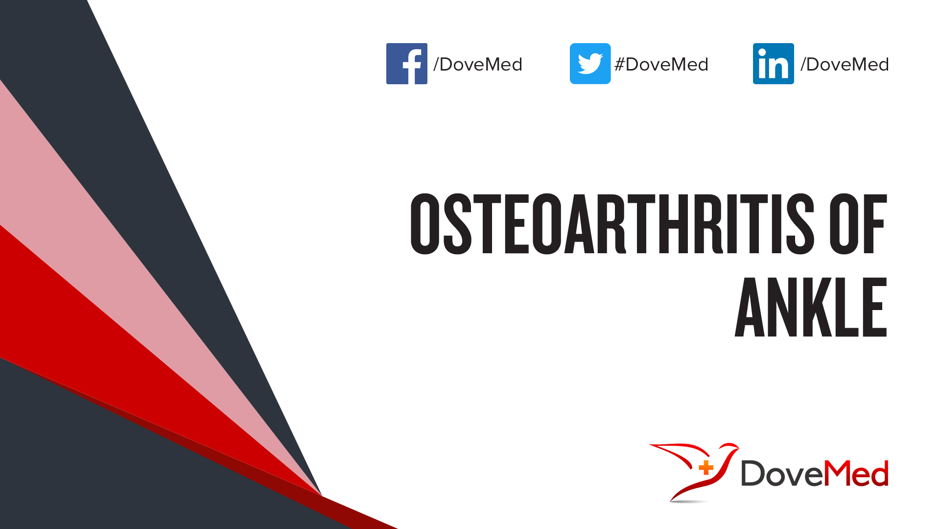 osteoarthritis-of-ankle