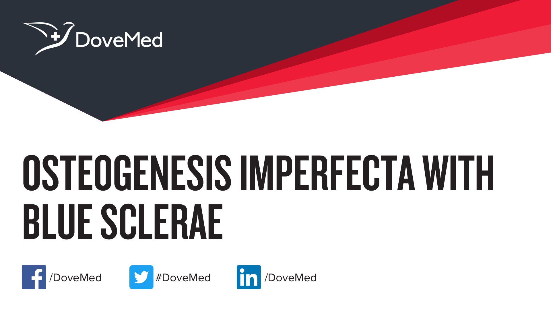 Osteogenesis Imperfecta with Blue Sclerae