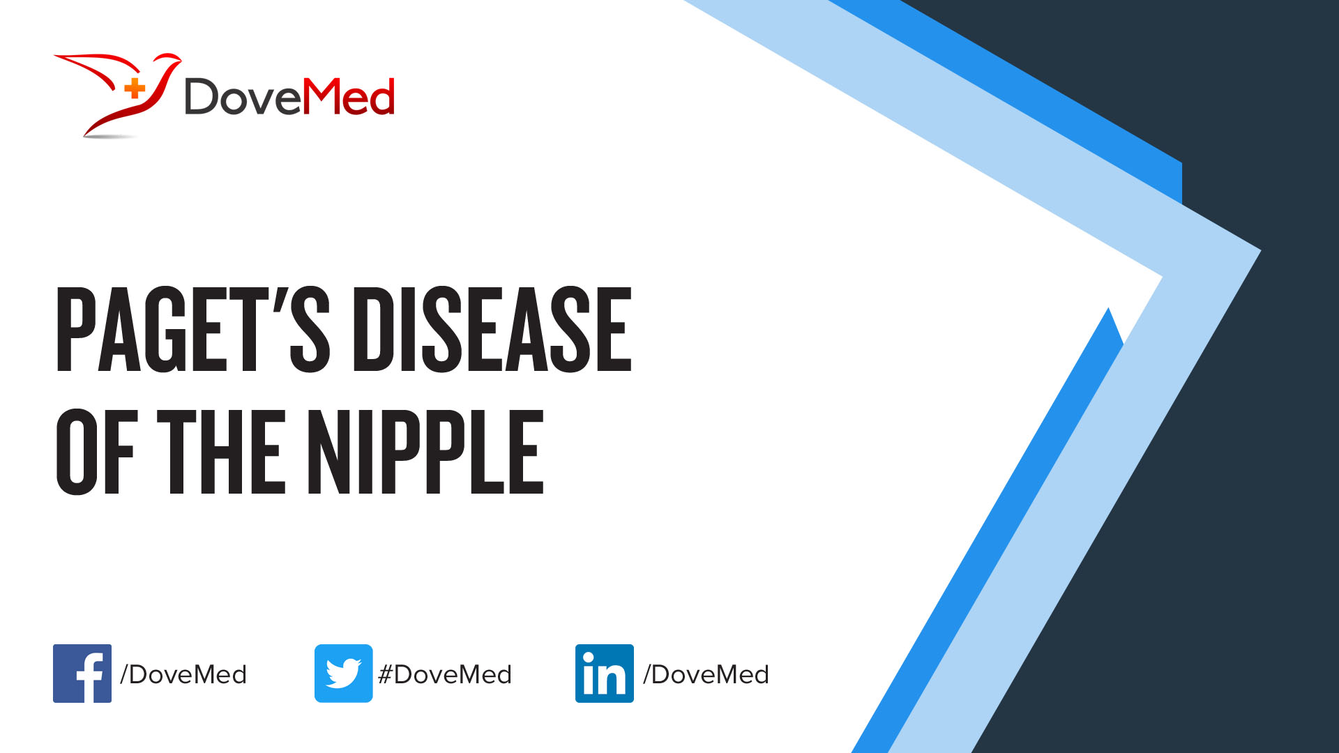 Paget’s Disease of the Nipple