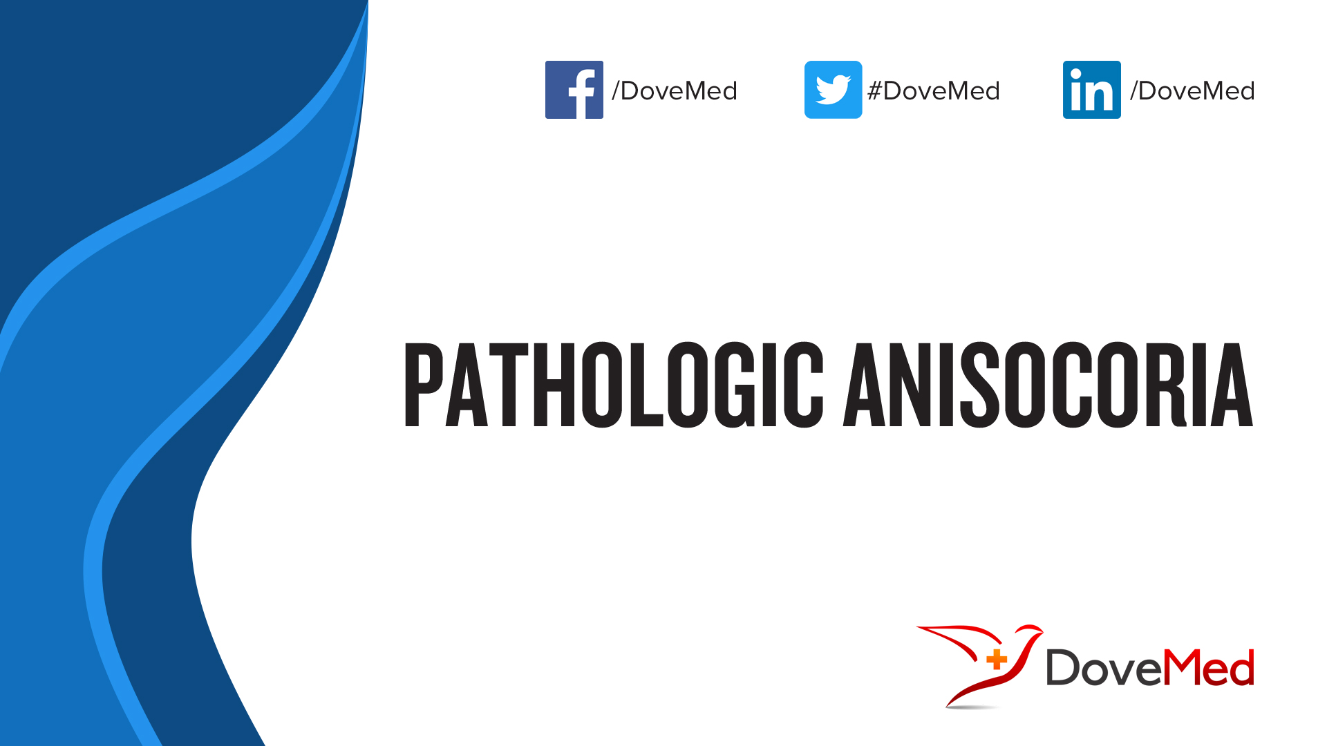 Pathologic Anisocoria