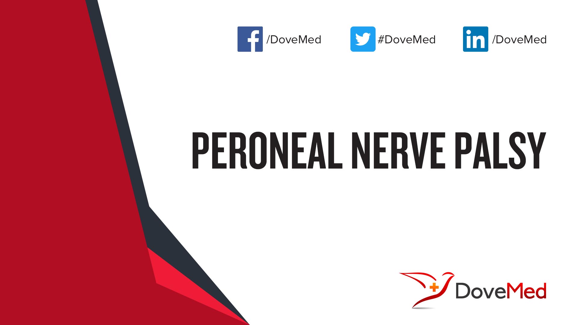 Peroneal Nerve Palsy