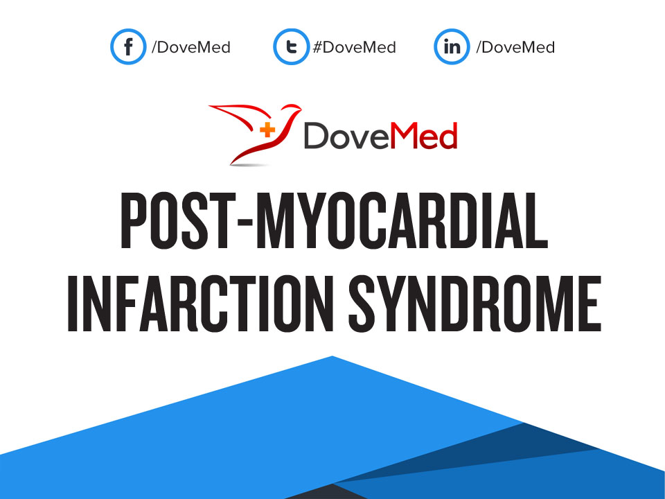 post-myocardial-infarction-syndrome