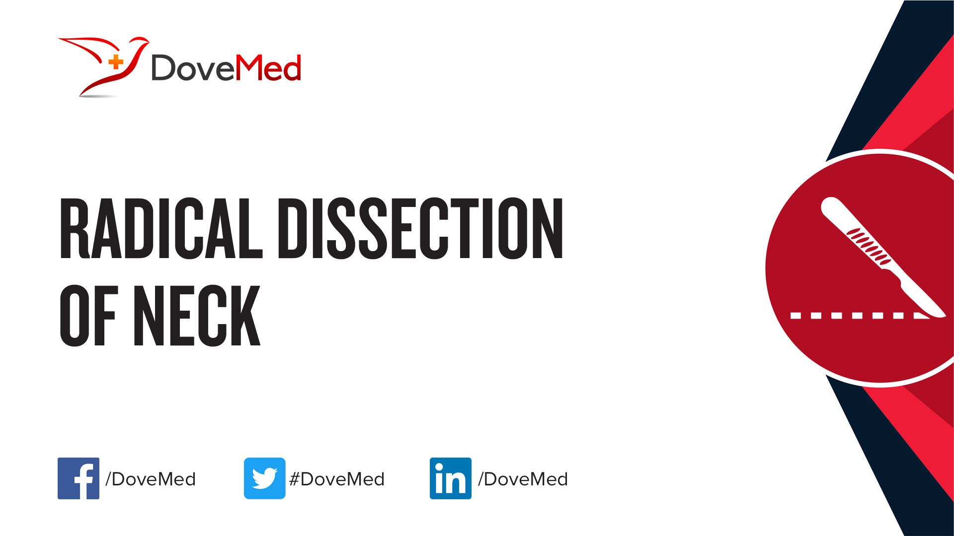 radical-dissection-of-neck