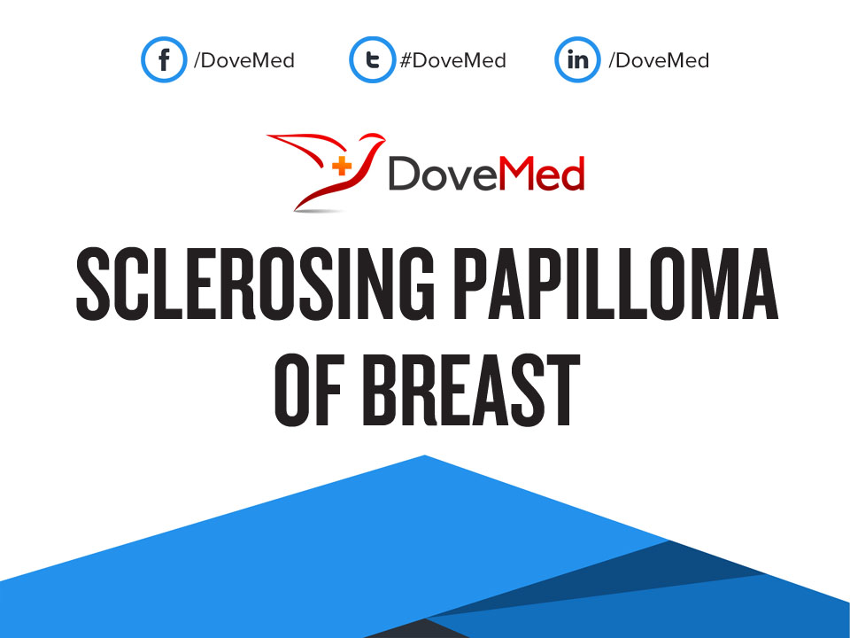 sclerosing intraductal papilloma right breast icd 10
