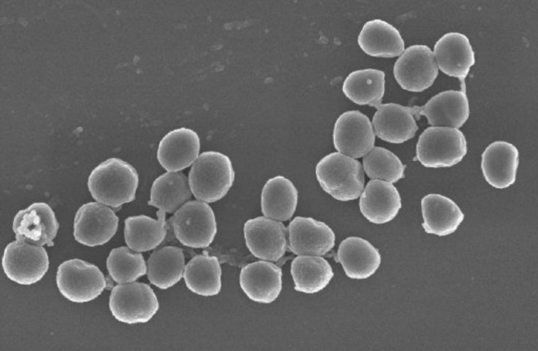 Staphylococcus aureus электронный микроскоп. St. aureus (золотистый стафилококк. Staphylococcus Albus под микроскопом.